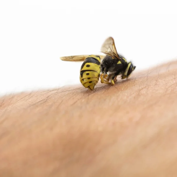 Une guêpe posée sur le bras d'une personne, montrant un contraste entre l'insecte et la peau humaine.